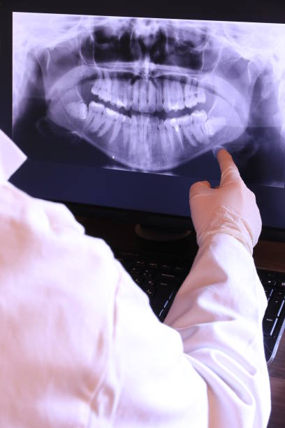 Best Broken or Cracked Tooth Emergency Dentist in Averill Park, NY