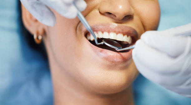 Best Emergency Dentist for Lost Fillings or Crowns in Averill Park, NY